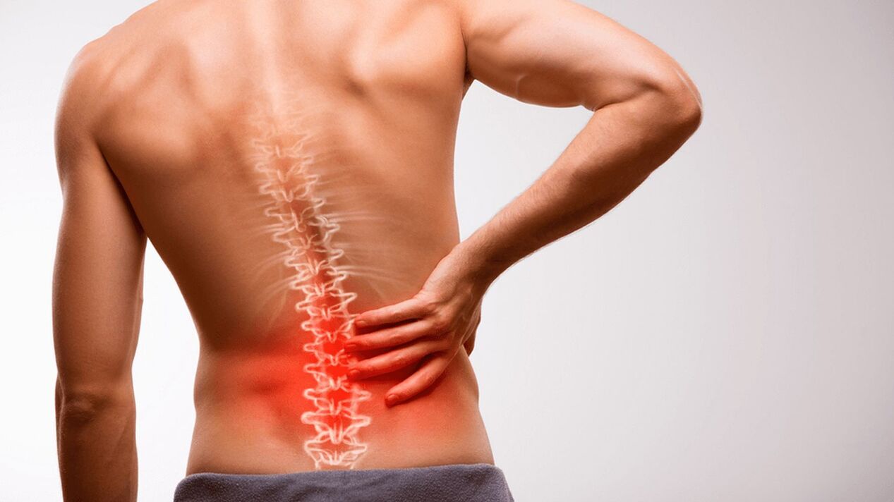 sciatica lombare
